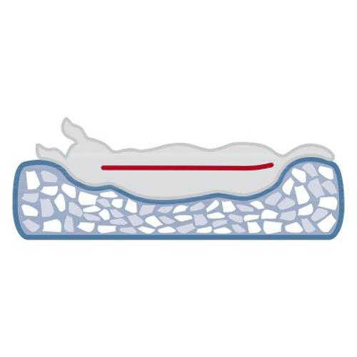 Trixie legowisko ortopedyczne Noah Dł. x szer. x wys.: 80 x 60 x 17 cm
